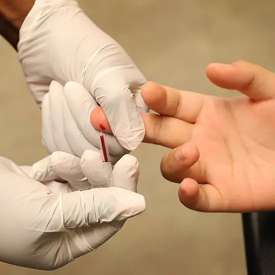 Chronic Fatigue Syndrome